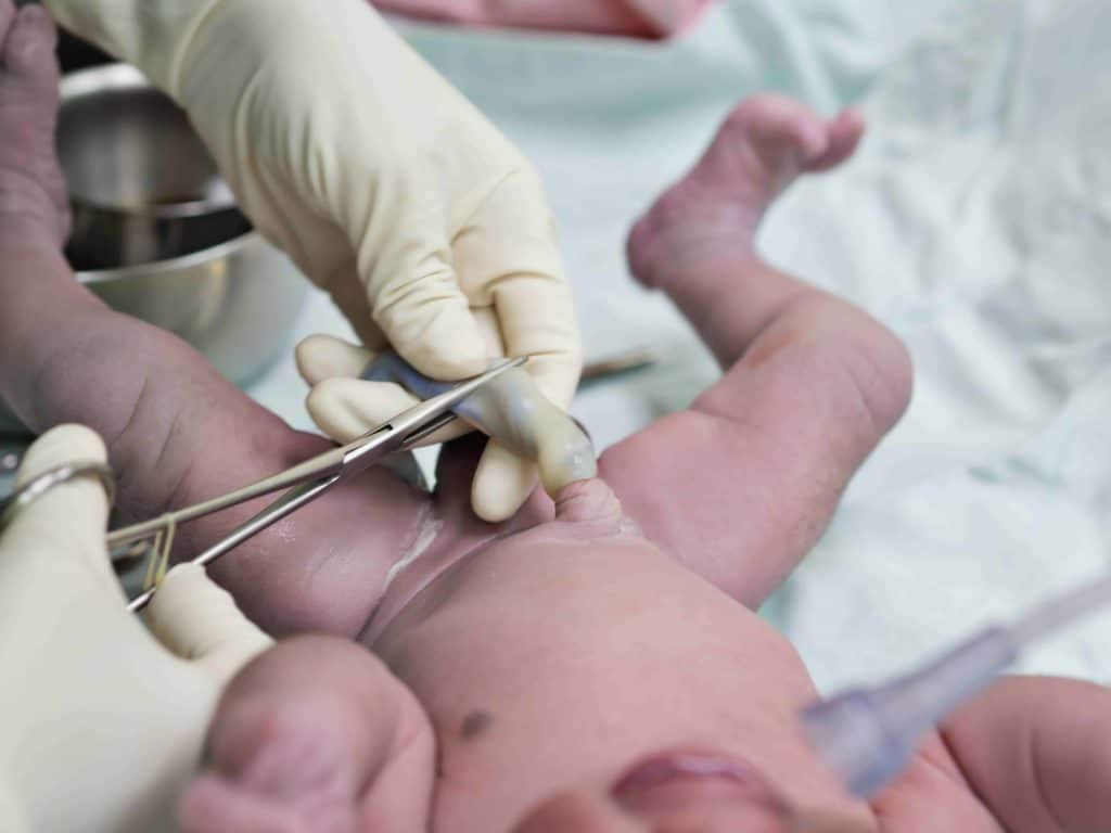 delayed cord clamping benefits umbilical cord