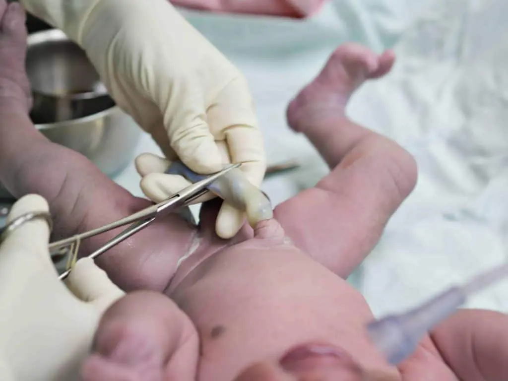 Clamping the umbilical cord straight after birth is bad for a baby's health  - The Standard Health
