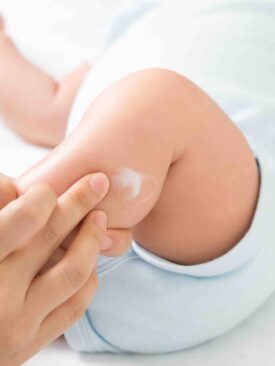 mom apply eczema cream to baby