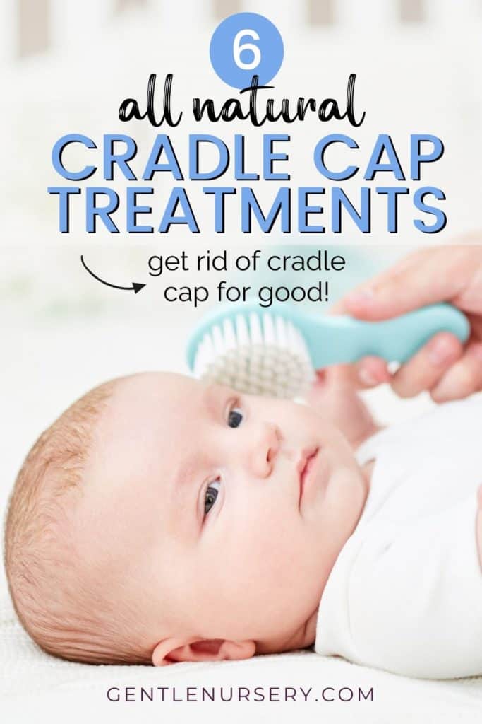 cradle cap at home treatment